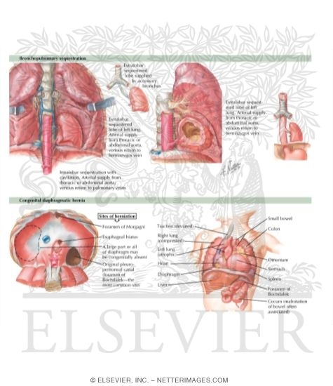 Watermarked preview of labeled image: Anatomic Abnormalities