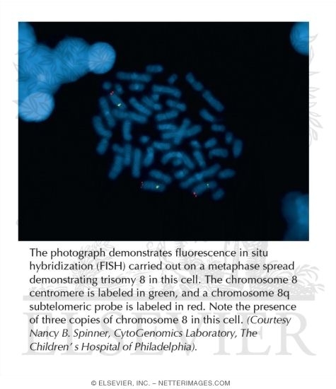 Fluorescent In Situ Hybridization (FISH) Detection of Aneuploidy
