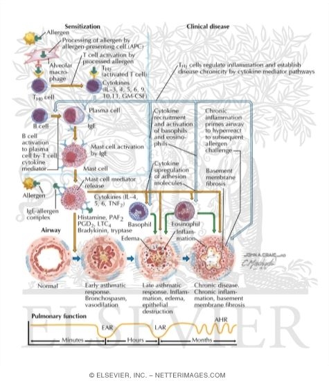 Watermarked preview of labeled image: Pathogenesis of Asthma