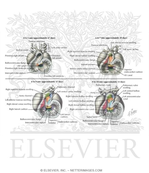 Spiral (Aorticopulmonary) Septum