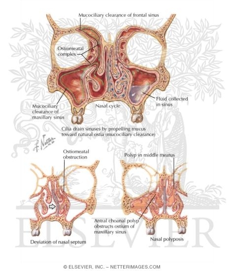 Watermarked preview of labeled image: Histology and Physiology of Nasal Cavity and Sinuses