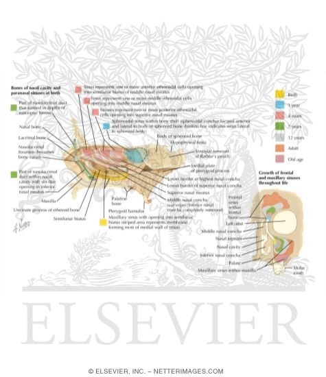 Watermarked preview of labeled image: Paranasal Sinuses: Changes With Age