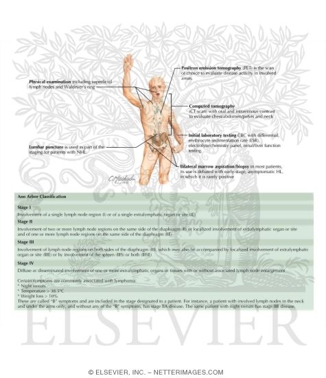 Watermarked preview of labeled image: Malignant Lymphomas - Staging