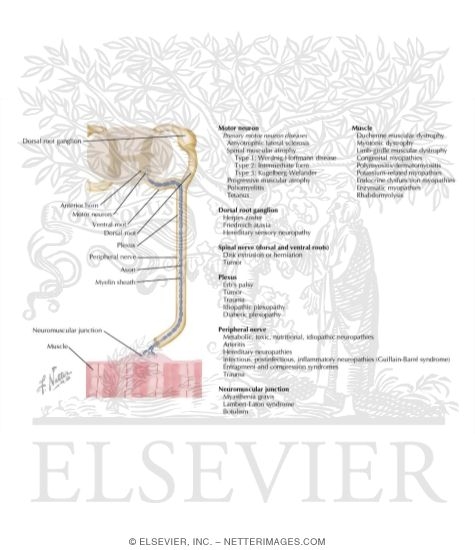 Watermarked preview of labeled image: Diseases of Motor-Sensory Unit: Regional Classification