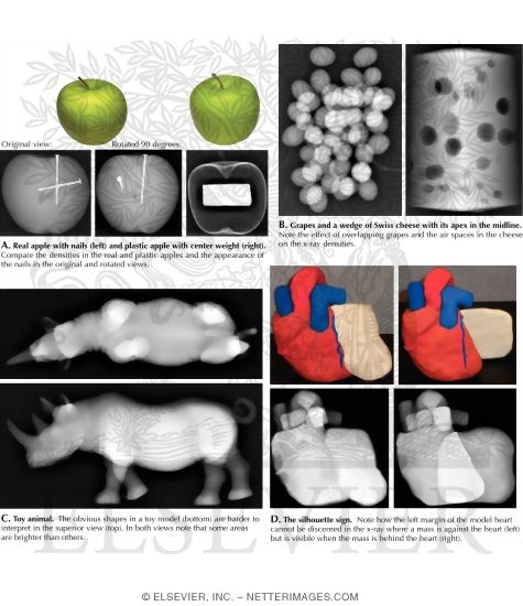 Interpretation of X-ray Densities