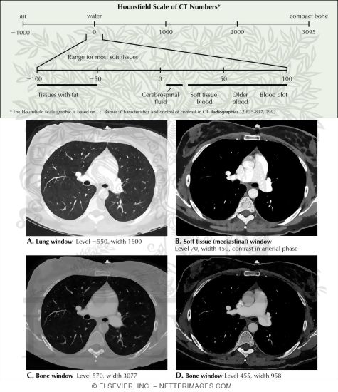 The Hounsfield Scale: CT Window Levels and Window Widths
