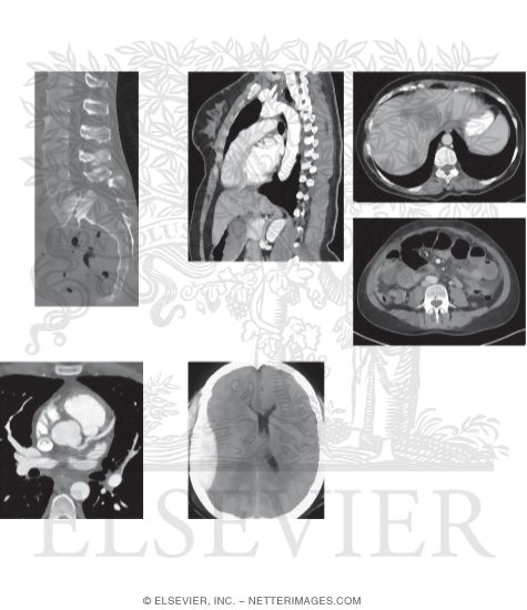 CT Uses, Advantages, and Disadvantages