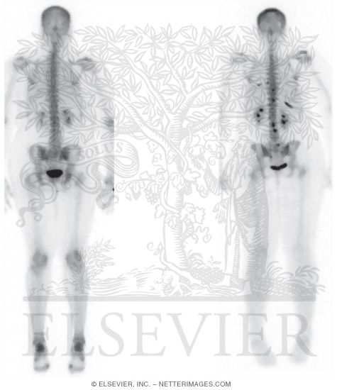 Nuclear Medicine Imaging