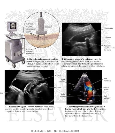Watermarked preview of labeled image: Ultrasound