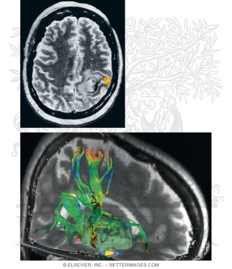 Watermarked preview of unlabeled image: Future Developments In Imaging