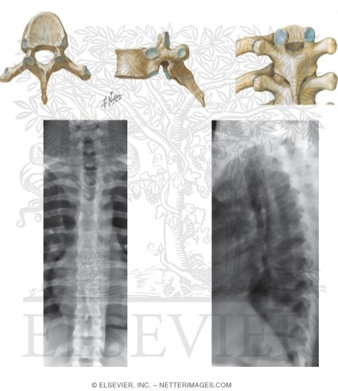 Thoracic Vertebrae