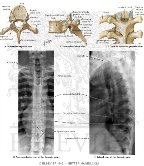 Thoracic Vertebrae