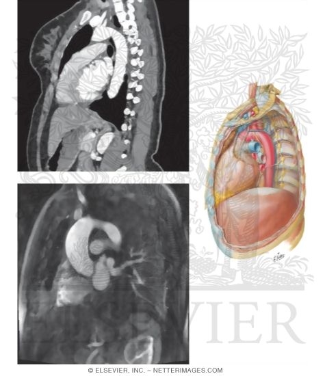 Sagittal CT and MRI