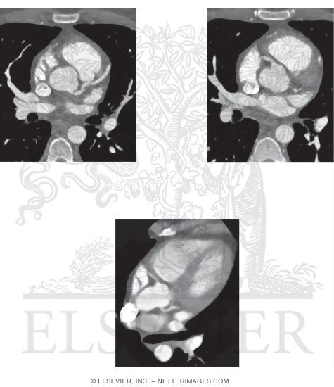 Watermarked preview of unlabeled image: Heart Imaging Studies