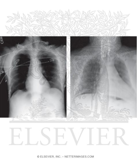 Search Stratgey: Upper Abdomen