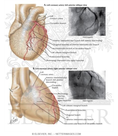 Watermarked preview of labeled image: Selective Cine Coronary Arteriography