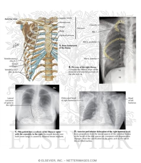 Thoracic Wall: Thoracic Cage (Skeleton)