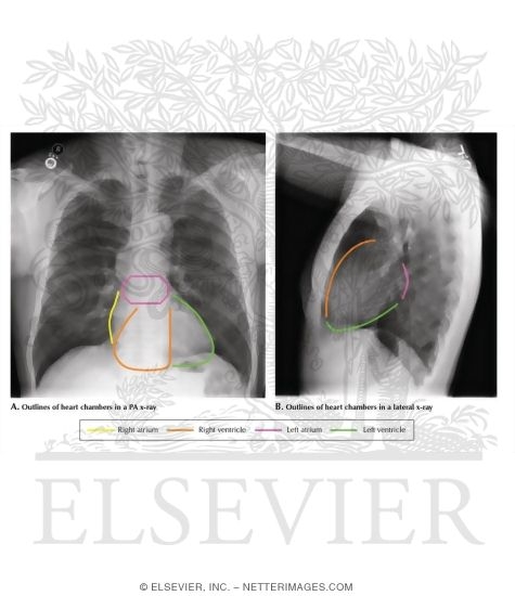 PA and Lateral X-Rays: Views of Superimposed Heart Chambers