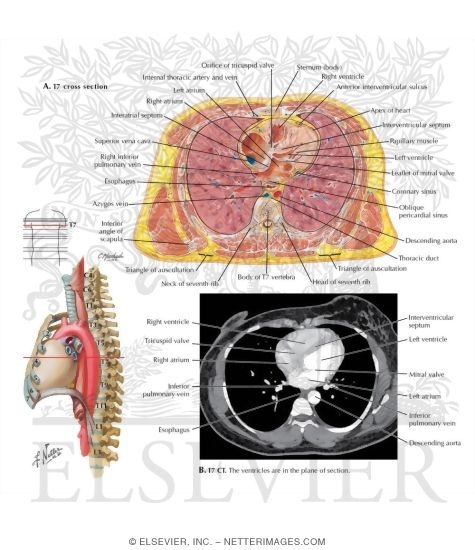 Watermarked preview of labeled image: T7 Cross Section With T7 CT
