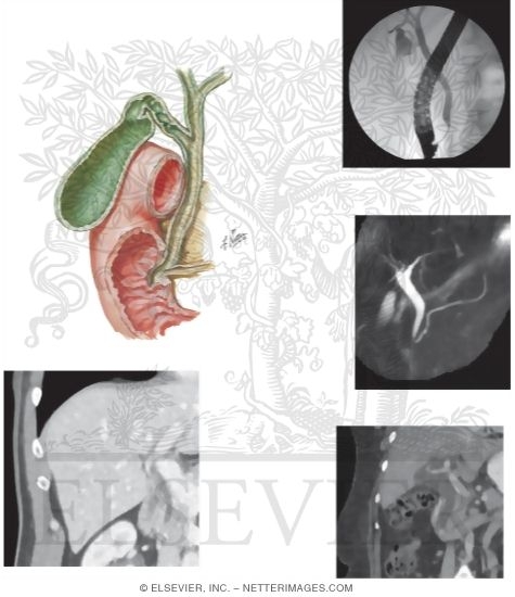 Gall Bladder and Bile Ducts