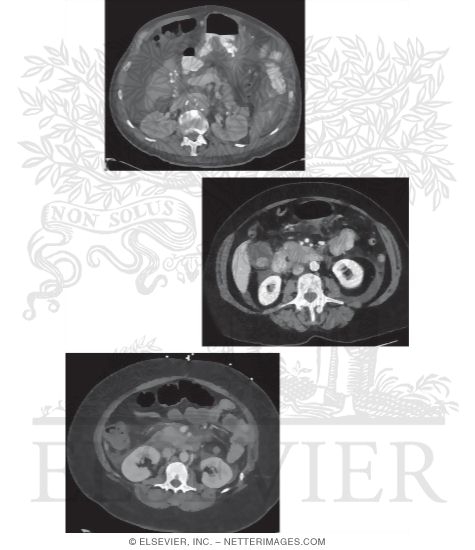 Gastrointestinal Pathology