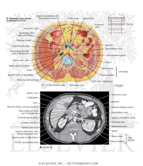 Cross Section at T12-L1 With CT