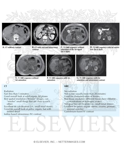 CT Vs. MRI In Abdominal Studies