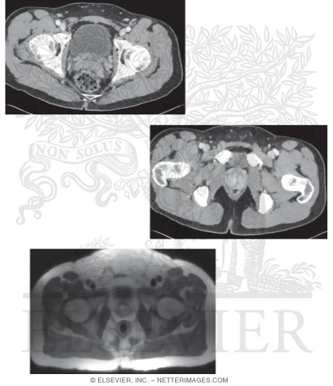 Watermarked preview of unlabeled image: Male Axial CT and MRI