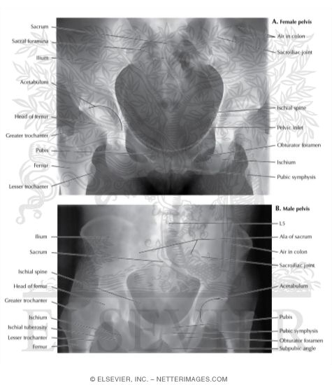 Female and Male Pelvis X-Rays