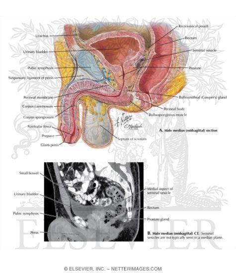 Male Midsagittal Section 