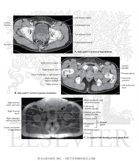 Watermarked preview of labeled image: Male Axial CT and MRI