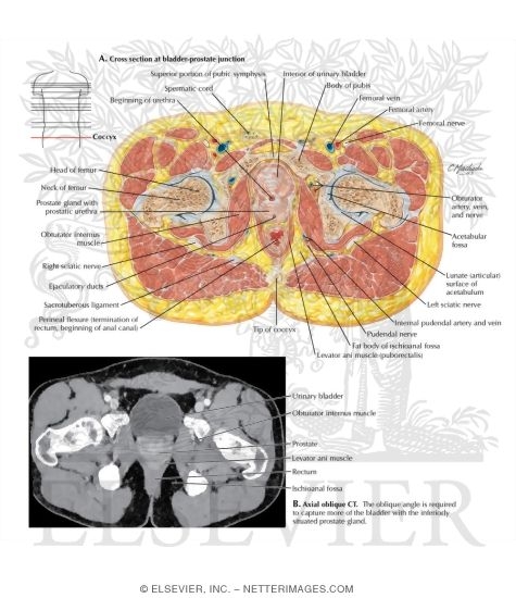 Cross Section at Bladder-Prostate Junction and CT
