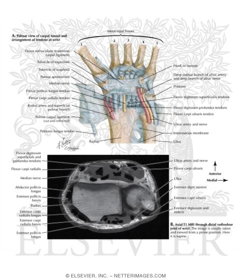 The Carpal Tunnel: Palmar View