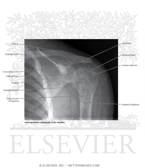 Anterior-Posterior Shoulder X-Ray (AP Radiograph of the Shoulder)