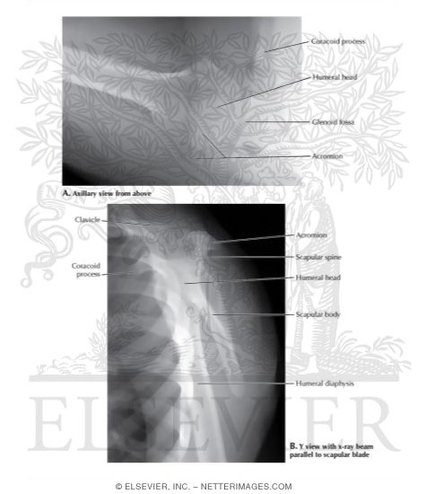 Axillary and Y View X-Rays of the Shoulder Joint