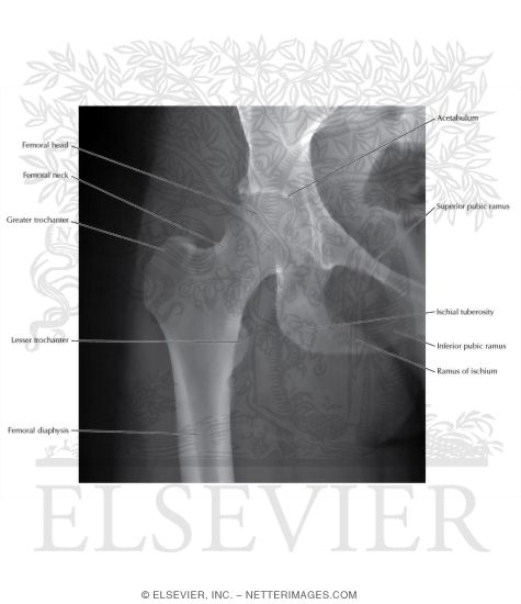 Hip Joint: X-Ray
