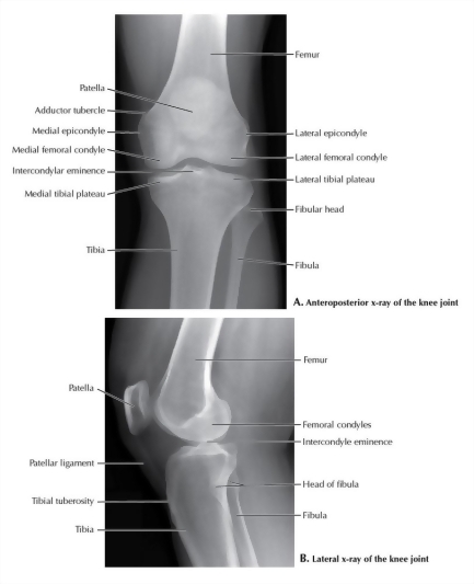 Knee Joint X-Ray 