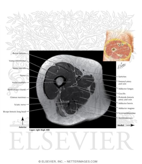Watermarked preview of labeled image: Upper Right Thigh T1 MRI