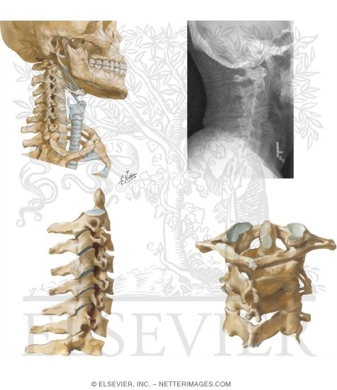 Watermarked preview of unlabeled image: Cervical Vertebrae and Lateral Radiograph 