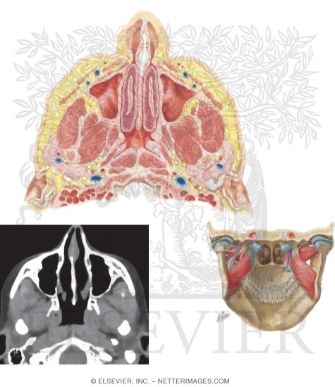 Watermarked preview of unlabeled image: The Nose, Nasal Cavity, and Maxillary Sinuses in the Transverse Plane 
