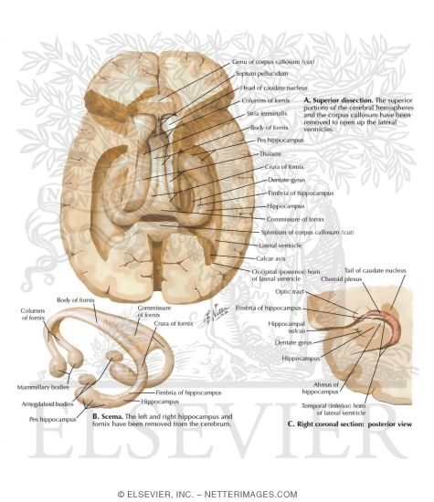 Watermarked preview of labeled image: Hippocampus and Fornix