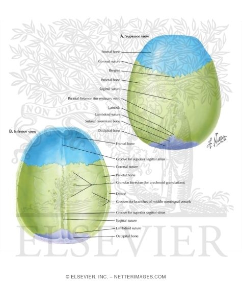 Calvaria [Showing Sutural (Wormian) Bone]