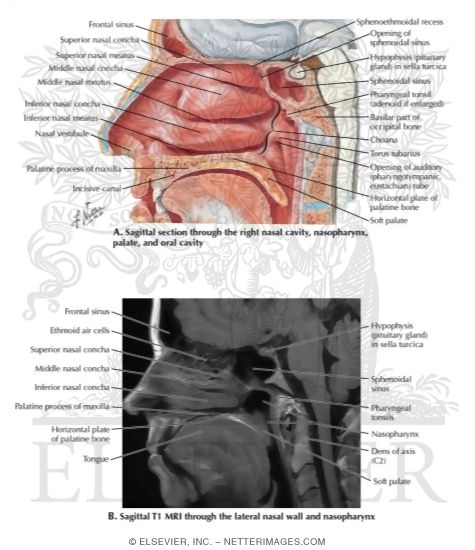 Watermarked preview of labeled image: Nasal Cavity