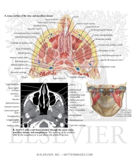 Watermarked preview of labeled image: The Nose, Nasal Cavity, and Maxillary Sinuses in the Transverse Plane 