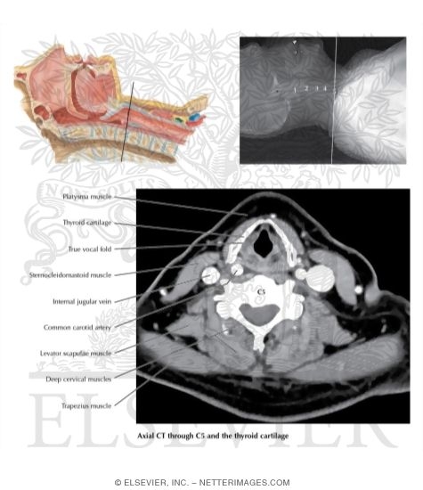 Pharynx: Median Section