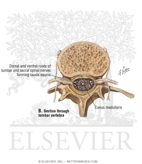 Watermarked preview of unlabeled image: Section Through Lumbar Vertebra