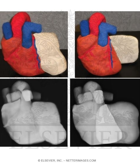 Watermarked preview of unlabeled image: The Silhouette Sign