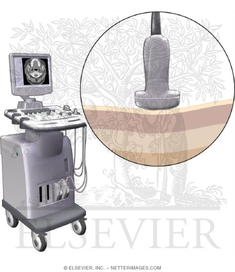 The Pulse-Echo Concept In Ultrasound