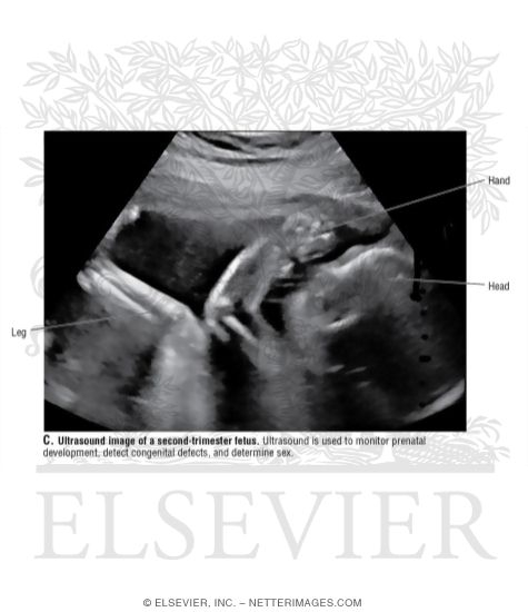 Ultrasound Image of a Second-Trimester Fetus
