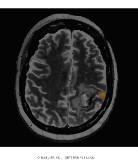 Watermarked preview of unlabeled image: BOLD Imaging